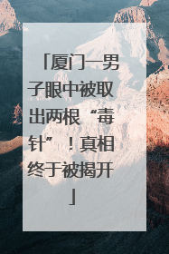 厦门一男子眼中被取出两根“毒针”！真相终于被揭开